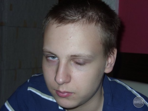 Môj ťik, viem tak divne mrkat lavym okom ;)