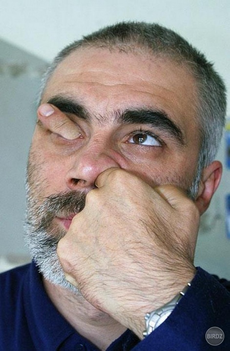 Obrázok