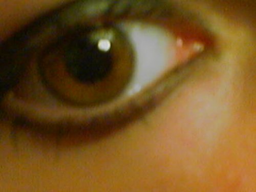 My eye
