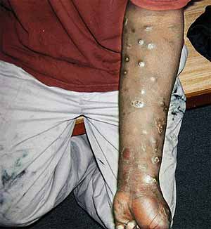 heroin addict- je to take fuj, že som to sem musela dať
