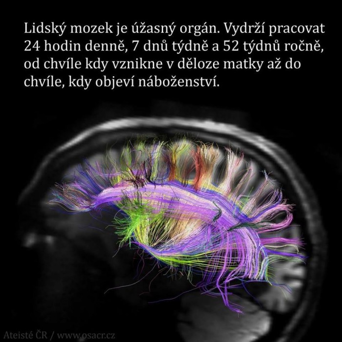 XD