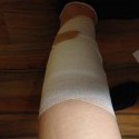 Milujem psíčkarov. Hlavne tých čo nepridržia svojho psa  keď vidia že chce útočiť keď je niekto na korčuliach. Ďakujem. Že krásny víkend. 