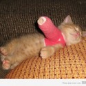 joj :///// broken arm