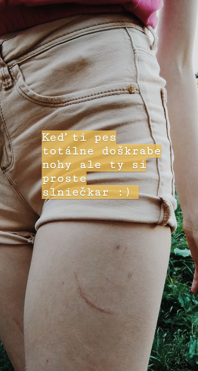 ---