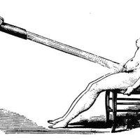 Vodní masážní přístroj pro léčbu ženské hysterie, cca 1865. 