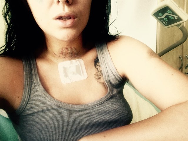 Moja jazva sa vola Ela a sme spolu sakra seksi