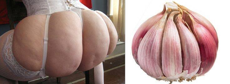 Cesnačka